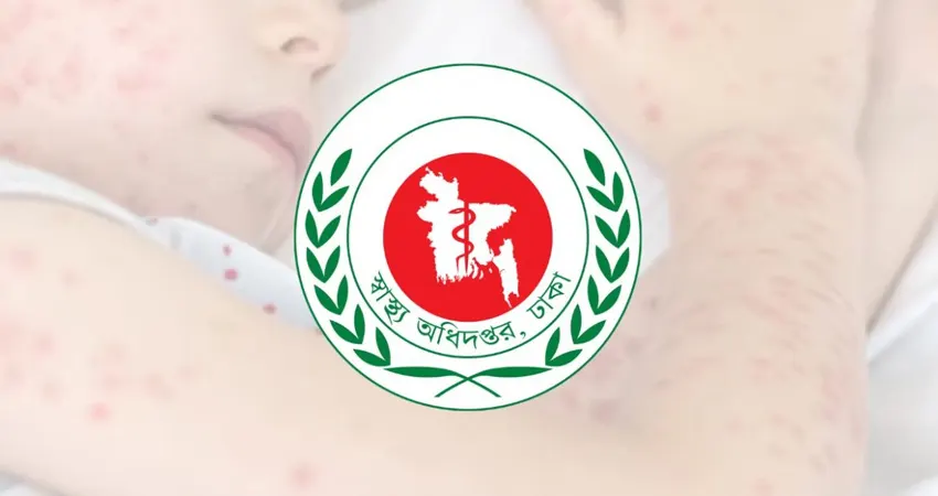 হামের উপসর্গে আরও ৩ জনের মৃত্যু, নতুন আক্রান্ত ১,২৬৮ জন