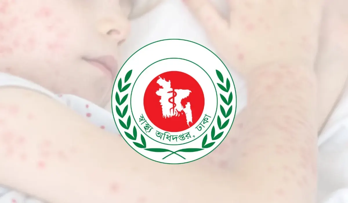 দেশে ২৪ ঘণ্টায় হামের উপসর্গে আরও ৫ জনের মৃত্যু