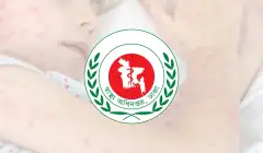 দেশে ২৪ ঘণ্টায় হামের উপসর্গে আরও ৫ জনের মৃত্যু