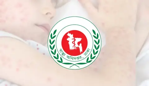 দেশে ২৪ ঘণ্টায় হামের উপসর্গে আরও ৫ জনের মৃত্যু