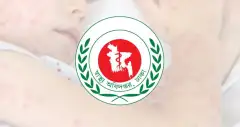 হামের উপসর্গে আরও ৩ জনের মৃত্যু, নতুন আক্রান্ত ১,২৬৮ জন